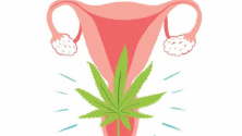 Teachlr.com - Fitocannabinoides en manejo de dolor crnico por endometrios